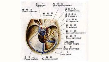 直窦(staight sinus)始于galen静脉与下矢状窦汇合的膨大处,是仅次于