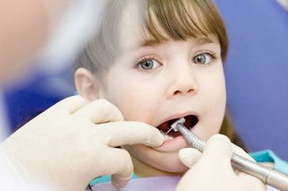 济南文建口腔门诊进口纳米树脂补牙套餐。仅售