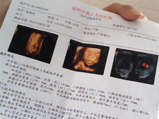 怀孕22周照<em>四维彩超</em>说<em>胎儿</em>三尖瓣囗返流是什