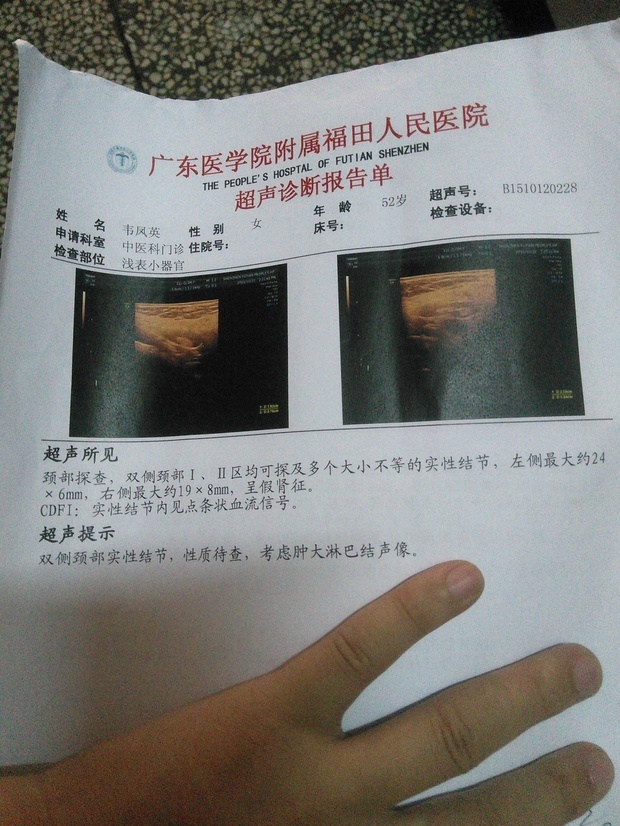 甲状腺良性肿瘤