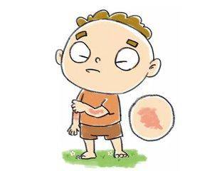 荨麻疹反复发作?芝麻油蒸鸡蛋就可治好!百治百