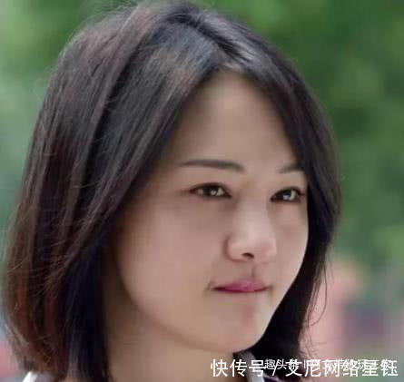 《青春斗》郑爽长胖被嘲大饼脸,嘴角暗黑色伤