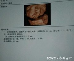 月,孕妈们要注意这4件事,可避免胎停和胎儿畸