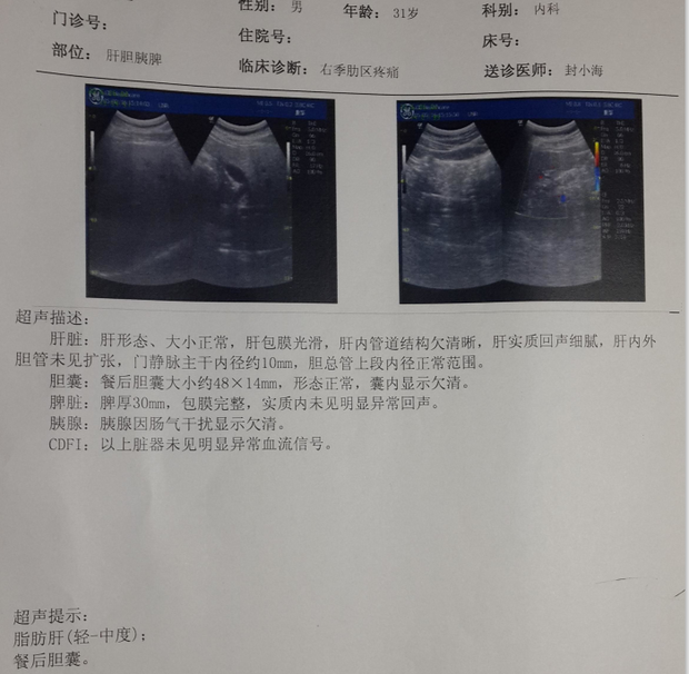 医生说我肝脏很不正常,b超显示有轻中度脂肪肝.于是做