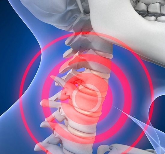 怎么治疗颈椎病 这几个方法让颈椎病不翼而飞