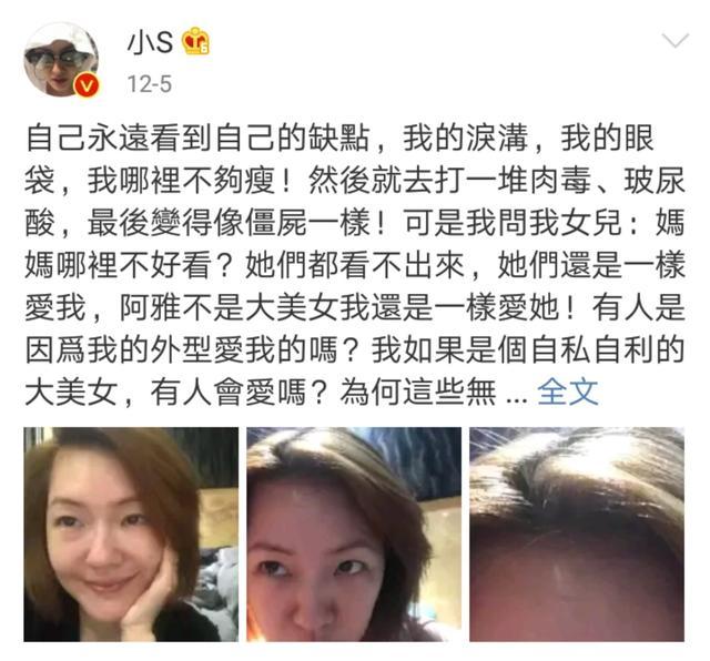 小S回娘家放飞自我这自拍角度很敢！耿直谈玻尿酸的她也是真性情