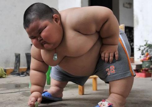 中国最胖儿童胖到连眼睛都睁不开,妈妈们注意孩子长胖