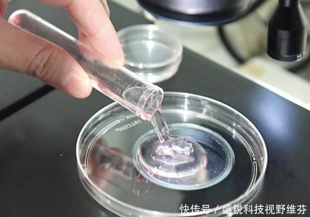 哪里可以做人工授精 t015da68b242e7b64b5.jpg