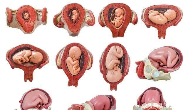 孕12周,为什么胎儿一直在右边?一起来看看胎宝