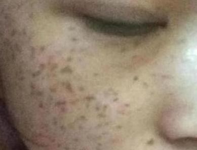 一般多少岁就有斑点 t0171cc32d431c9d8a3.jpg?size=389x296