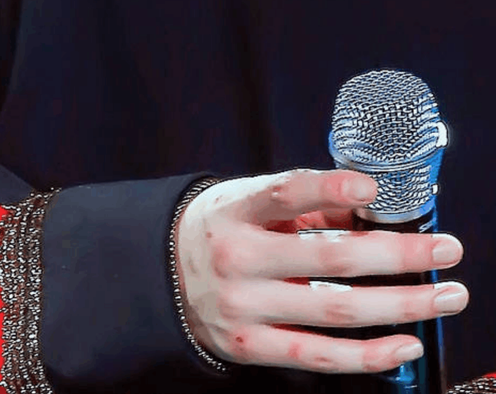 蔡徐坤过敏李紫婷进医院黄明昊满手窟窿,艺人