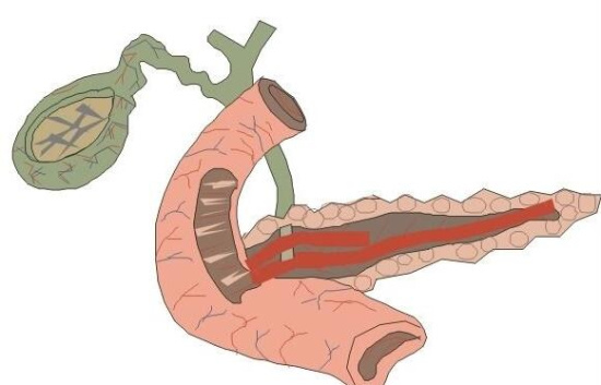 科学家成功培养胆管"类器官" 有望减少肝移植需求