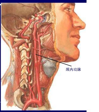 颈内动脉