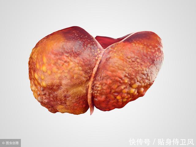 肝不好的人,常用蒲公英泡水喝,不出半个月,肝病