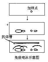 免疫电泳