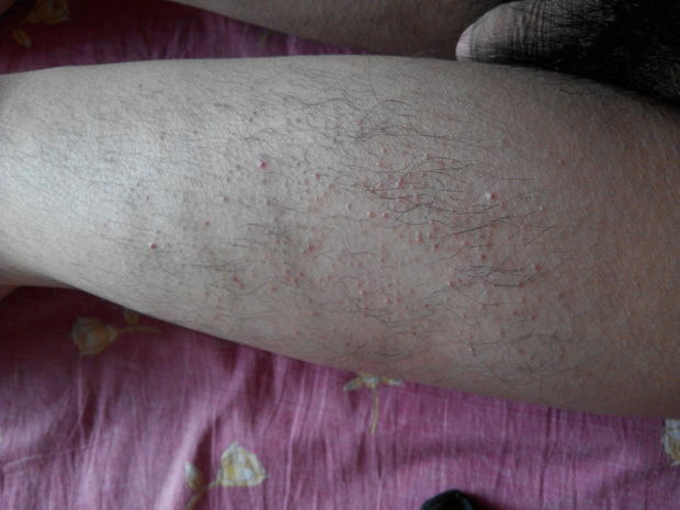 t01a103adb9781350ee.jpg