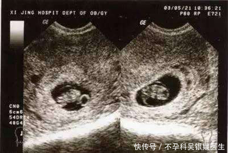 备孕小知识:什么是排卵期和安全期?