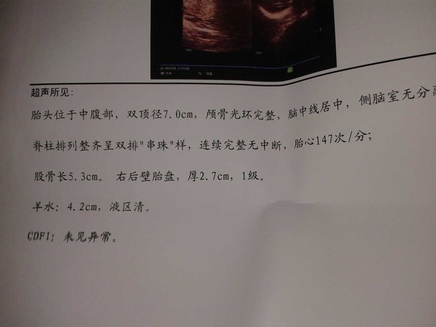 我老婆怀孕30+6周了去医院检查医生说胎儿小还没31周