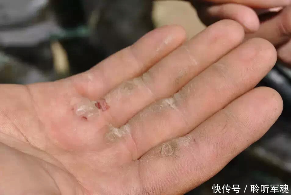 当兵都知道有个科目不仅危险,还扯掉手上的老