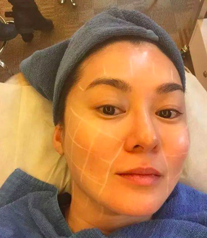 她曾艳压李嘉欣却患抑郁症自残，如今44岁为保容颜整容险丧命！