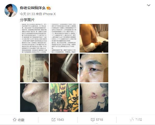 仙洋爆料自己被打，巴扎黑欺人太甚：走着瞧，我真的忍无可忍了！