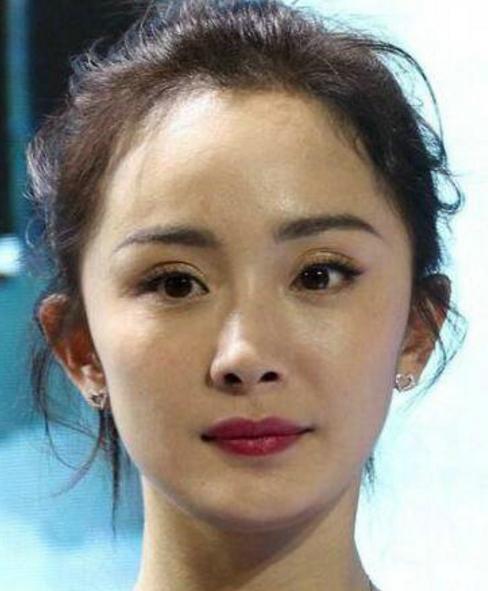 右眼变形什么原因,右眼变形什么原因引起的