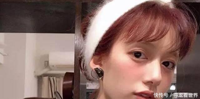 杨颖整牙,李诞女友整牙,傅园慧也整牙,网友:我也