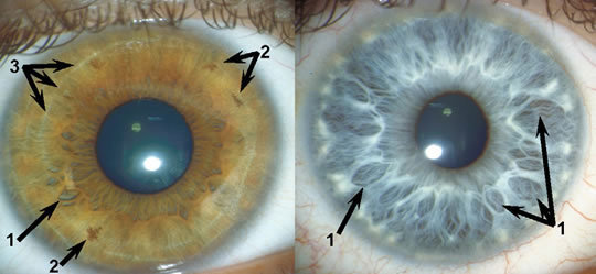 新生儿什么时候可以看到瞳孔 t01b556c8c6db434a7d.jpg