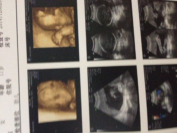 大家觉得是<em>女宝</em>还是男宝啊,有经验的宝妈们_3