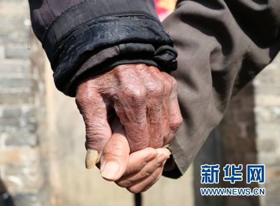 93岁的任清华老人和老伴一双牵了66年的手,是情人节最好的礼物.
