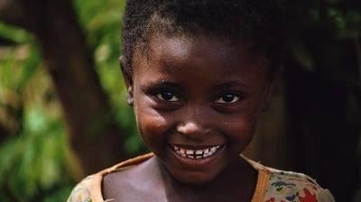 非洲人那么黑,为什么他们的牙齿普遍都很白?看