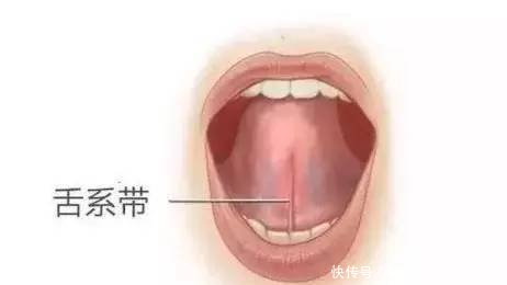 怎么样判断小孩是不是舌系带短呢?