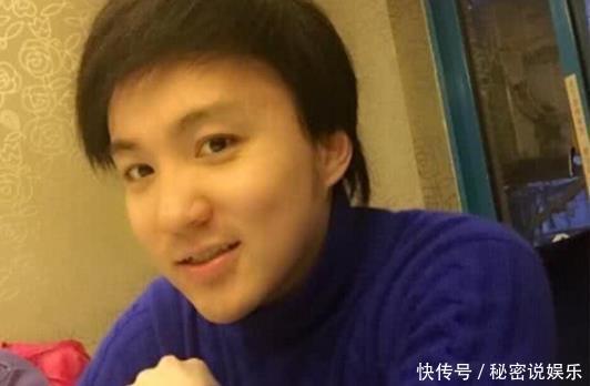 曾演三毛红遍全国,却拍戏造成秃顶植发手术缝