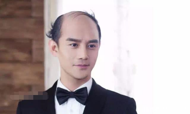 谁秃顶崩塌型式王俊凯颜值驾驭,胡歌令人窒郭德纲发发型图片图片