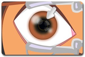 朵拉眼睛手术,朵拉眼睛手术小游戏,360小游戏
