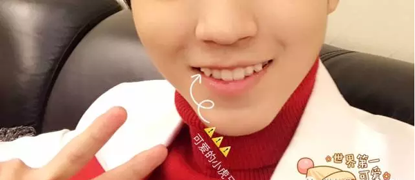 王俊凯戴牙套了,虎牙还会有吗?|娱乐影视-化龙巷