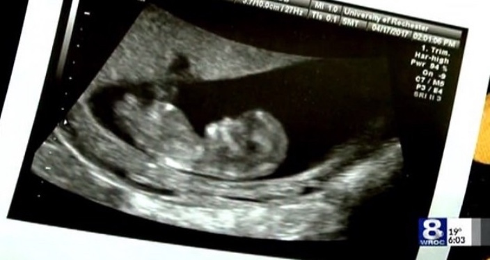 女友怀孕4个月,被医生男友故意下药流产,法庭