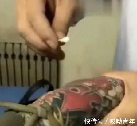 男子去医院打针，露出手臂的那一刻，护士小姐姐无语了