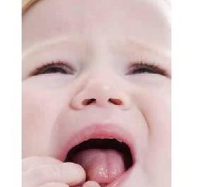 2岁宝宝出疹子,糊涂母亲听信网上建议不给药吃