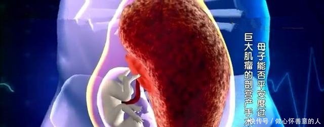 女大学生怀孕8个月产检,医生要求剖腹,男友一