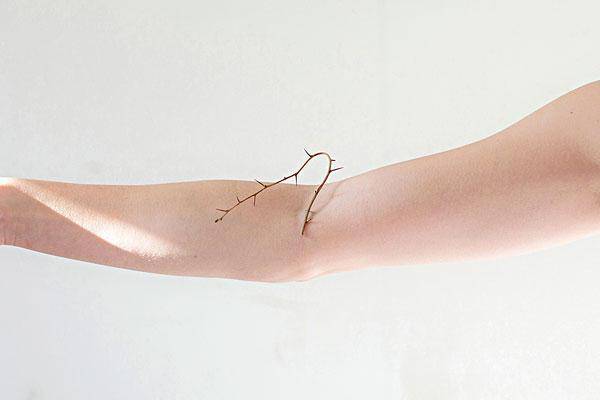 受伤要防破伤风,但注射的却可能是早被淘汰的