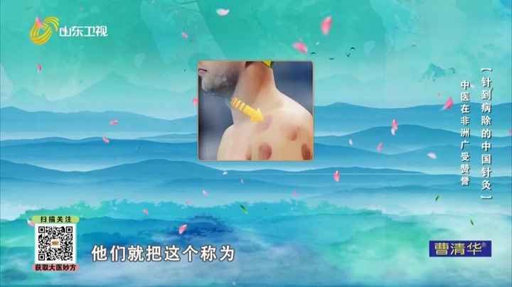 大医本草堂 针到病除的中国针灸