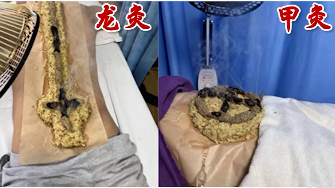 X诊所. 夏季扶阳正当时 三伏除病有良方（下）