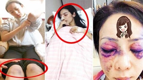 萝莉说美女 第一季 娱乐圈被“暴虐”的女星