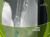 走近科学 《走近科学》 20180410 超级显微镜