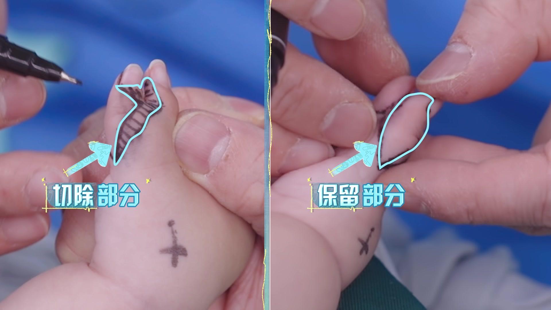 你好，儿科医生第四季 《你好，儿科医生第四季》第7集纯享版（中）