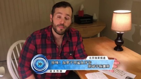 蓝天娱乐快报 2016 7月 惊悚 加男子用鲨鱼牙齿刺破手腕囊肿 160701