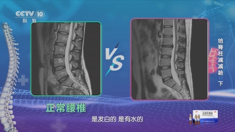 健康之路 《健康之路》 20240109 给脊柱减减龄（下）