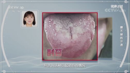 健康之路 《健康之路》 20200731 擦不掉的汗渍