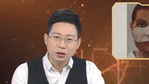 经典传奇 中国换脸第一人李国兴 揭秘其离奇死亡之因